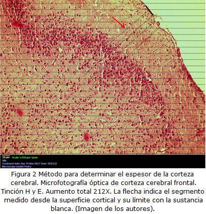 figura2