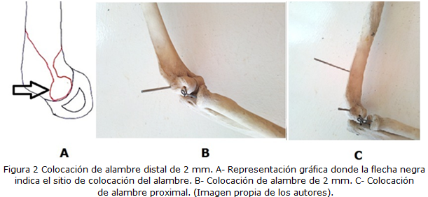 Figura 2