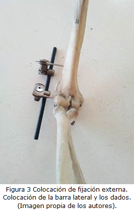 Figura 3