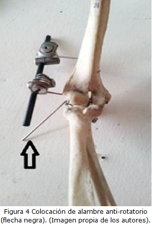 Figura 4