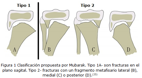 figura1