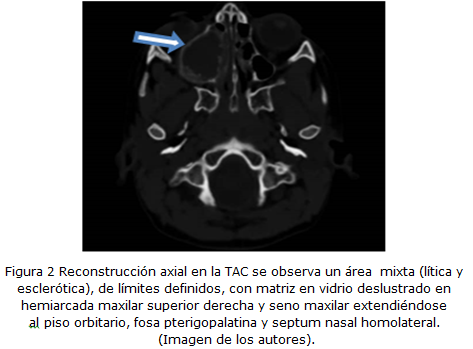 Figura 2