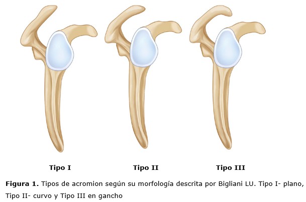 figura 1