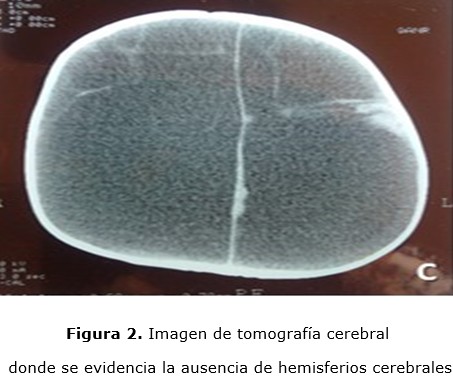 figura 2