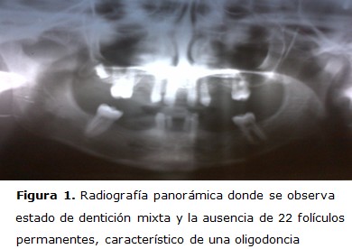 figura 1