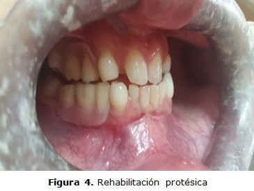 figura 4