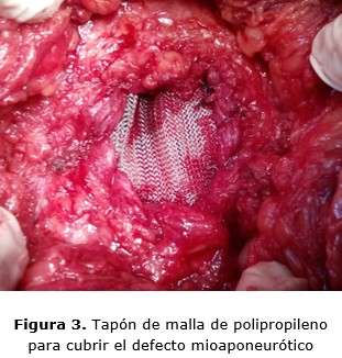 figura 3