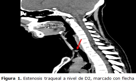 figura 1