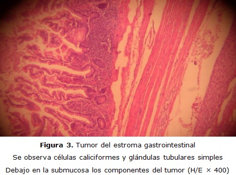 figura 3