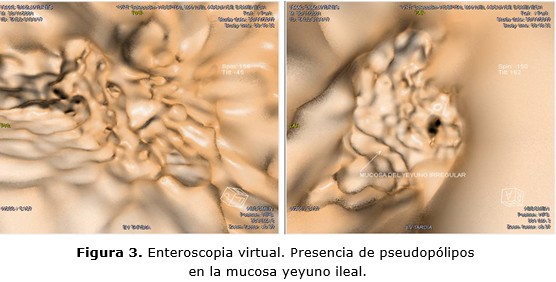 figura 3