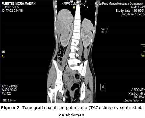 figura 2