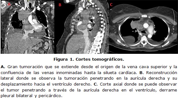 figura 1