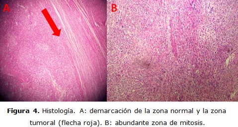 Figura 4