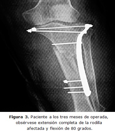 figura 3