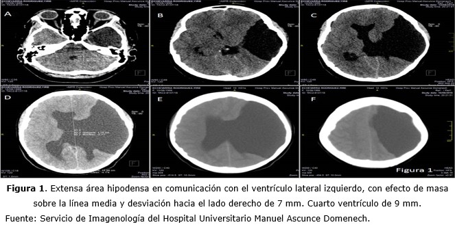 Figura 1