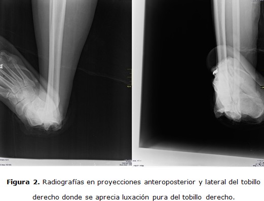 figura 2