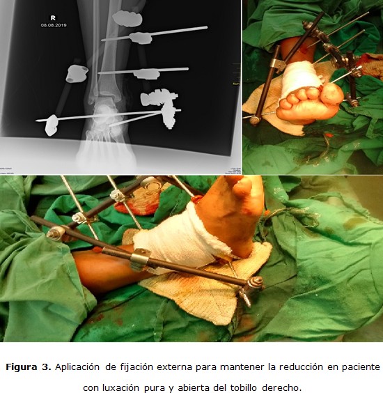 figura 3