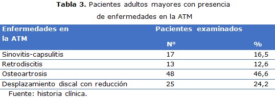 Tabla 3