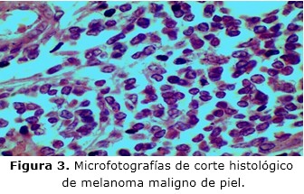 figura 3