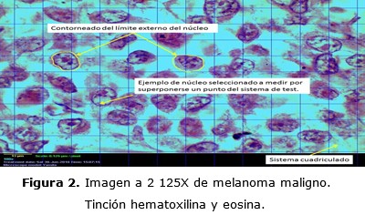 Figura 2