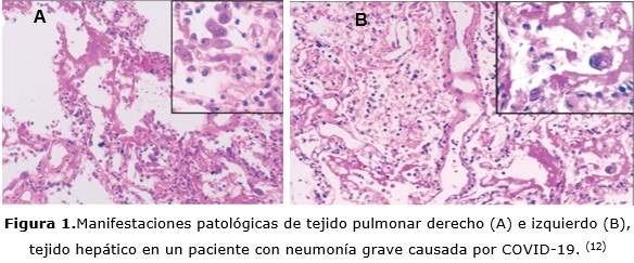 figura 1