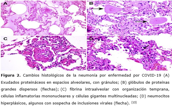 histología de fibrina