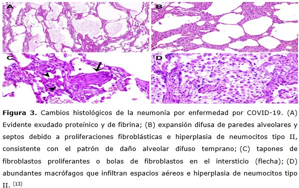 histología de fibrina