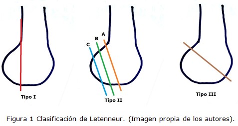 Figura 1