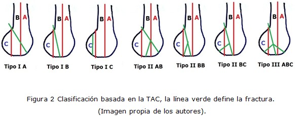 Figura 2