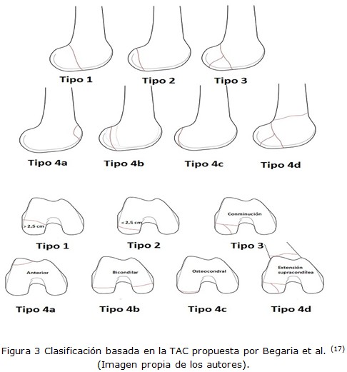 Figura 3