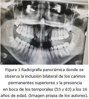 Figura 1