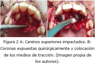 Figura 2