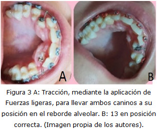 Figura 3