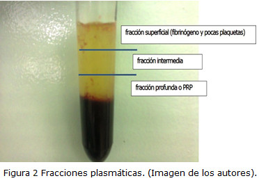 Figura 2