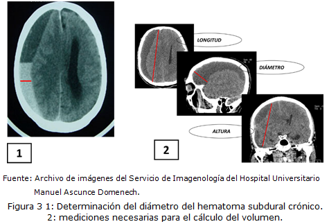 figura 3