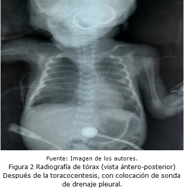 figura 2