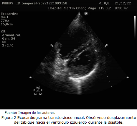 figura2